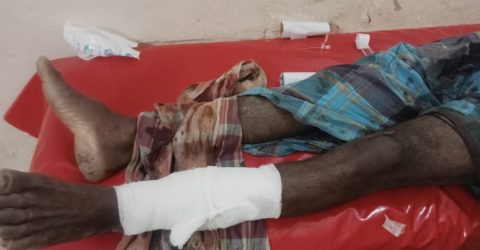 পটুয়াখালীর কলাপাড়ায় চাচার পায়ের রগ কর্তন করলেন ভাতিজা