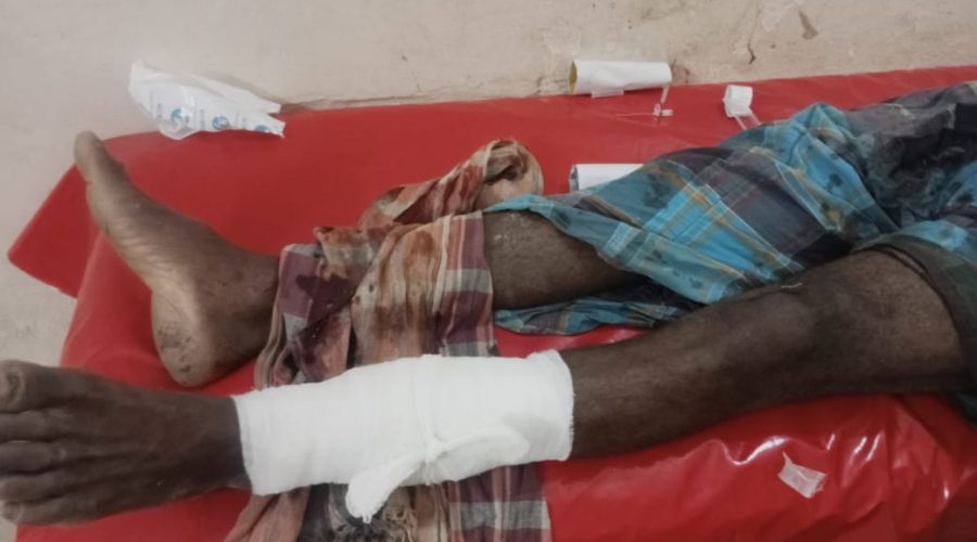 পটুয়াখালীর কলাপাড়ায় চাচার পায়ের রগ কর্তন করলেন ভাতিজা পটুয়াখালীর কলাপাড়ায় চাচার পায়ের রগ কর্তন করলেন ভাতিজা