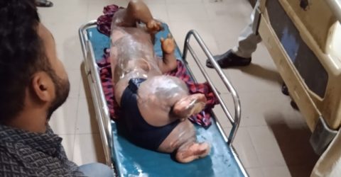 নোয়াখালীতে অটোরিকশার সিলিন্ডার বিস্ফোরণে পাঁচ শিশুসহ আহত-৬