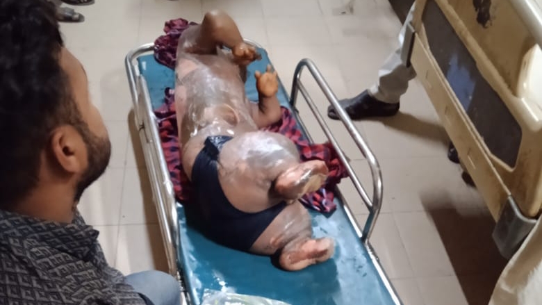 নোয়াখালীতে অটোরিকশার সিলিন্ডার বিস্ফোরণে পাঁচ শিশুসহ আহত-৬ নোয়াখালীতে অটোরিকশার সিলিন্ডার বিস্ফোরণে পাঁচ শিশুসহ আহত-৬