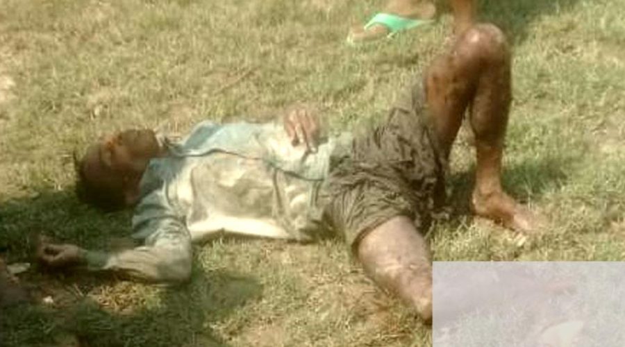 টেকনাফ নাফ নদীতে মাইন বিস্ফোরণে যুবকের পা বিচ্ছিন্ন টেকনাফ নাফ নদীতে মাইন বিস্ফোরণে যুবকের পা বিচ্ছিন্ন
