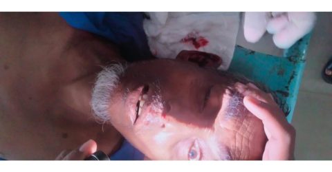 বীরগঞ্জে শ্যামলী কোচের ধাক্কায় অটো চালক মোস্তফা নিহত, আহত-১