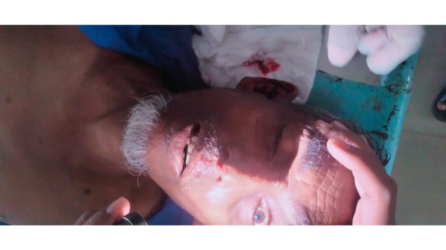 বীরগঞ্জে শ্যামলী কোচের ধাক্কায় অটো চালক মোস্তফা নিহত, আহত-১ বীরগঞ্জে শ্যামলী কোচের ধাক্কায় অটো চালক মোস্তফা নিহত, আহত-১