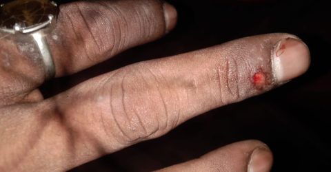 আবারও সাংবাদিক মাসুম ইসলাম রাহাতের উপর হামলা