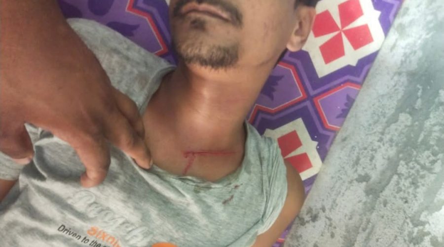 কাজিরহাটে পাওনা টাকা নিয়ে সংঘর্ষে আহত ১